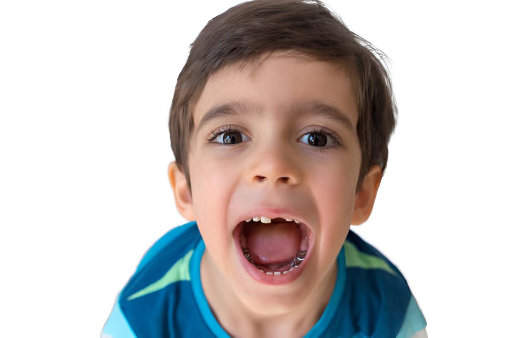 stainless steel crowns pulaski