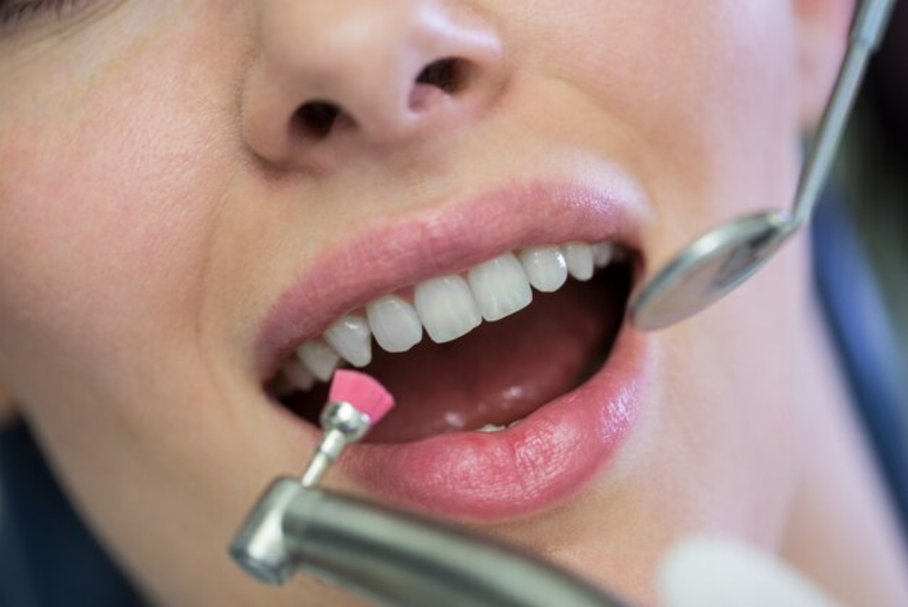 Looking for dental sealants near me? Protect your smile with expert dental sealants in Pulaski. Schedule your appointment today for lasting cavity protection!